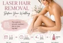 Best Time to Get Laser Hair Removal Before Your Wedding
